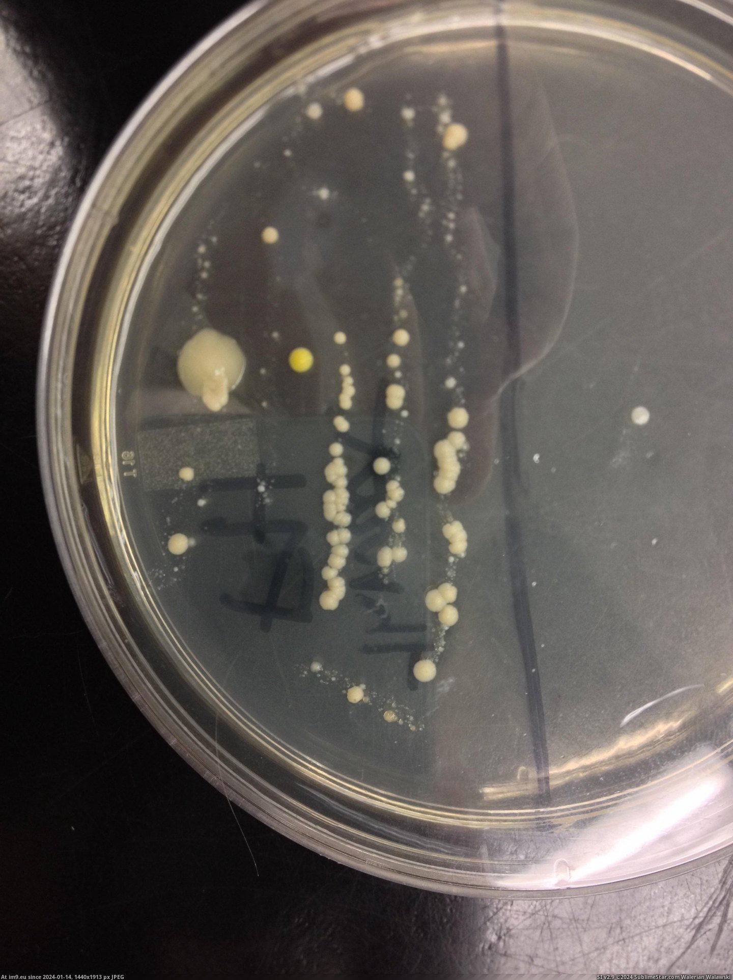 #For #Out #Did #Biology #Staph #Strep #Anthrax #Throat #Lab #Culture [Mildlyinteresting] Found out I have Strep, Staph, and Anthrax in a recent throat culture I did for biology lab Pic. (Изображение из альбом My r/MILDLYINTERESTING favs))