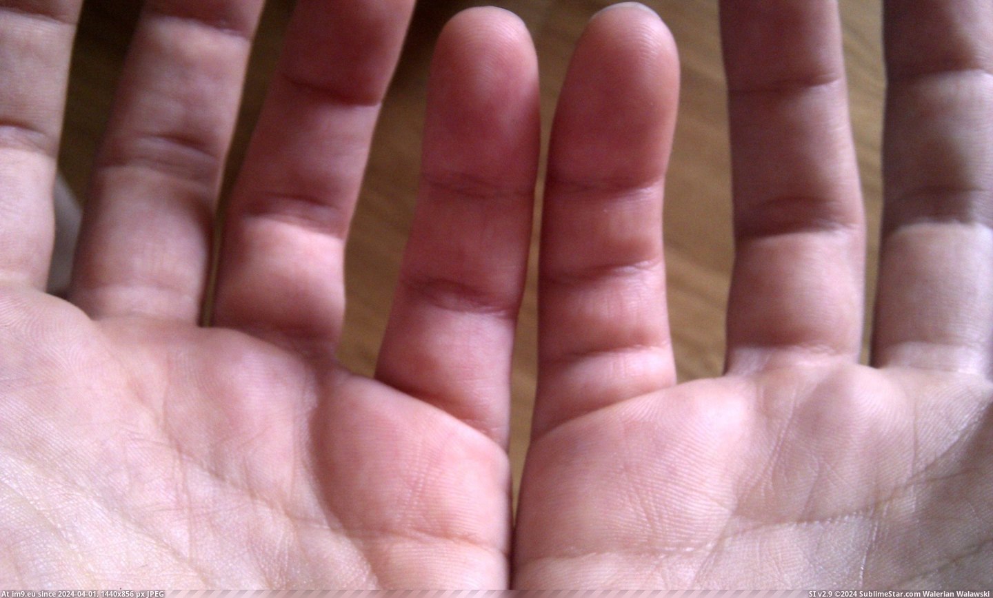 #Finger #Crease #Extra [Mildlyinteresting] I have an extra crease on my little finger Pic. (Image of album My r/MILDLYINTERESTING favs))