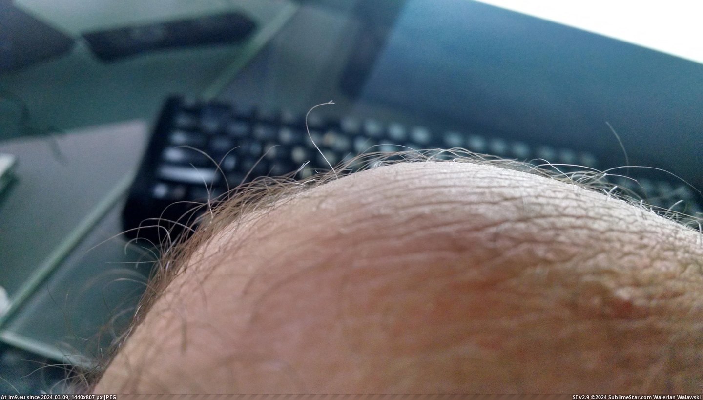 #Hair #Leg #Split #End [Mildlyinteresting] My leg hair has a split end. Pic. (Obraz z album My r/MILDLYINTERESTING favs))