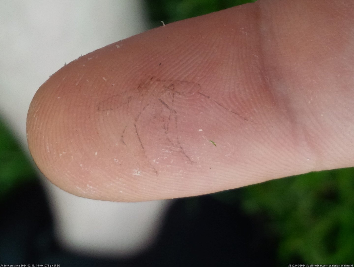 [Mildlyinteresting] Slapped a mosquito out of the air and got an imprint of its last moment on my finger (in My r/MILDLYINTERESTING favs)
