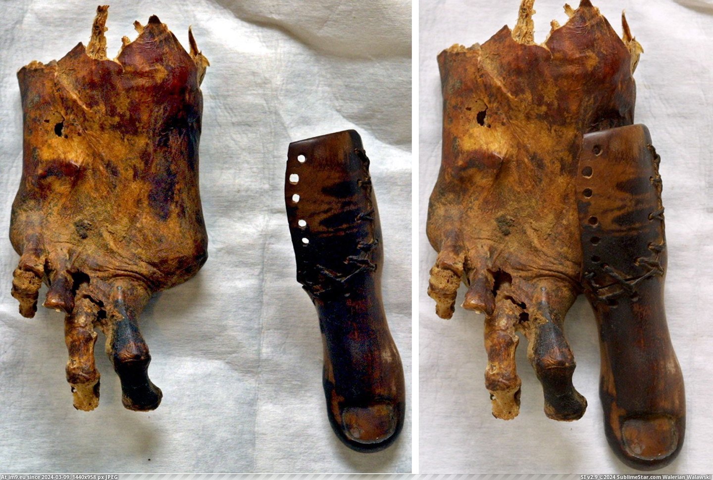 #Wtf #Years #Old #Prosthetic #Mummy #Foot #Toe #Egyptian [Wtf] Foot of egyptian mummy with a prosthetic toe. 3000 years old. Pic. (Image of album My r/WTF favs))