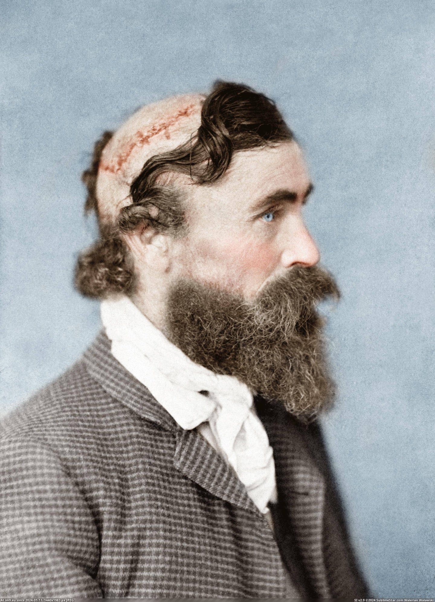 #Wtf #Was #Man #Sioux #Chief #Mcgee #Scalped #Child #Turtle #Robert [Wtf] Robert McGee, a man who was scalped as a child by the Sioux Chief Little Turtle, 1864 Pic. (Изображение из альбом My r/WTF favs))