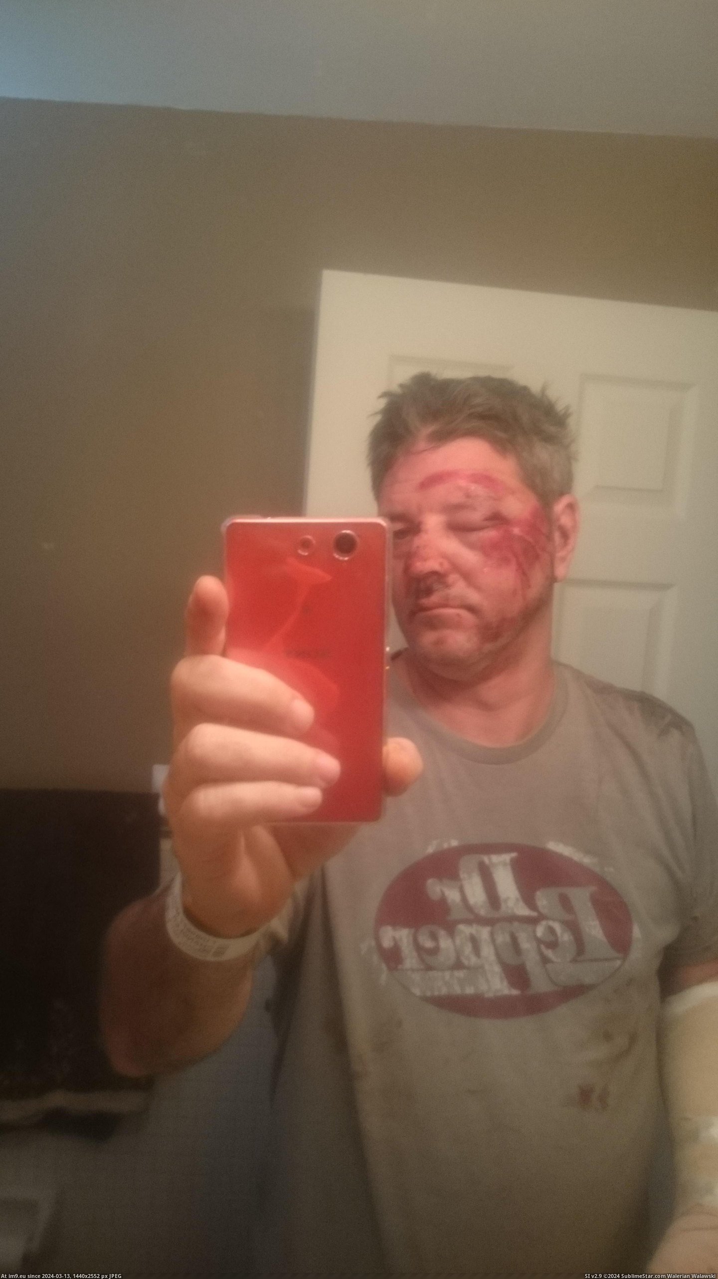 #Wtf #Hit #Driver #Bike #Riding #Run [Wtf] Was riding my bike, and was run over by a hit and run driver 3 Pic. (Image of album My r/WTF favs))