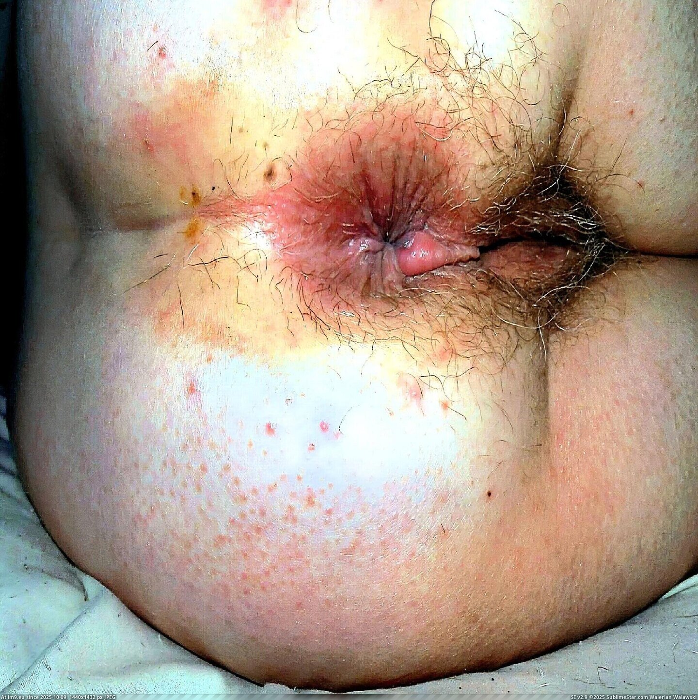 #Amateur #Slut #Mature #Scat #Stained #Dirty #Nasty #Shit amateur 3 Pic. (Imagen de album amature amateur))