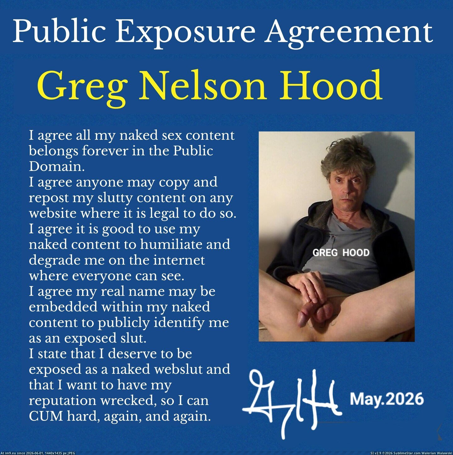 in Public Webwhore Greg GregNHoodexposed Pic. (Imagen de album Public Webwhore Greg))