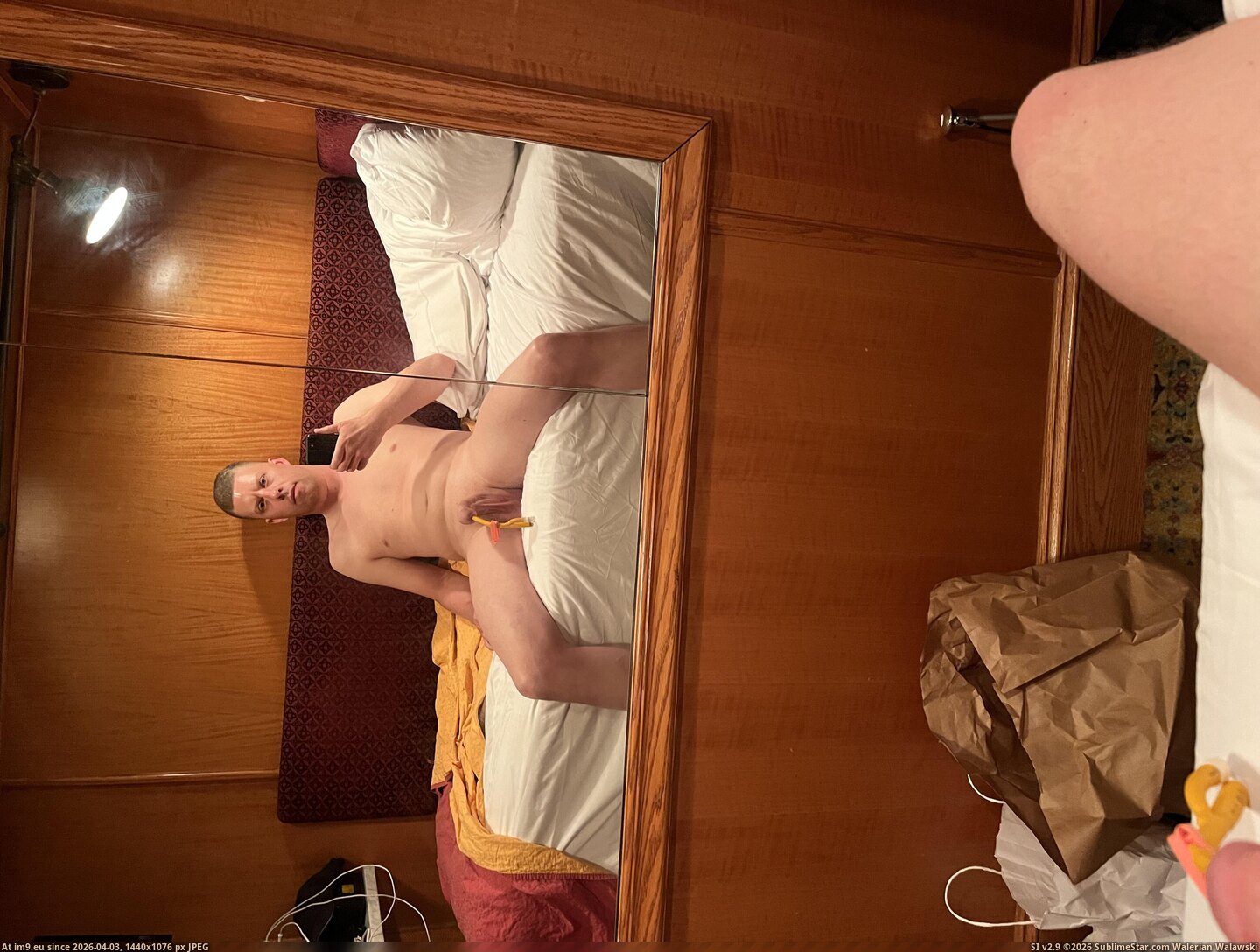 #Nude #Slut #Naked #Exposed #Christaweber #Demed #Waiblingen #Universitatsklinik #Lonsing #Esslingen #Outdoor IMG_2218 Pic. (Imagen de album Jan Klein, Zähringer Straße 12, 79108 Freiburg, Germany - Medartis GmbH))