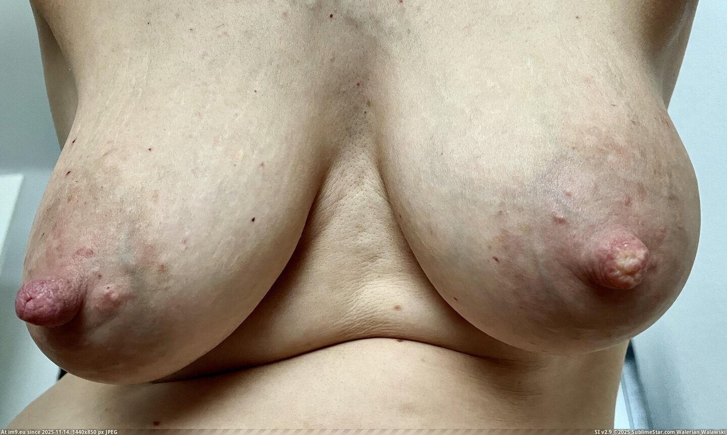 #Milf #Big #Nippleplay #Norsk #Nipples #Wife IMG_4379 Pic. (Image of album Norsk wife big nipples Norwegian Milf))