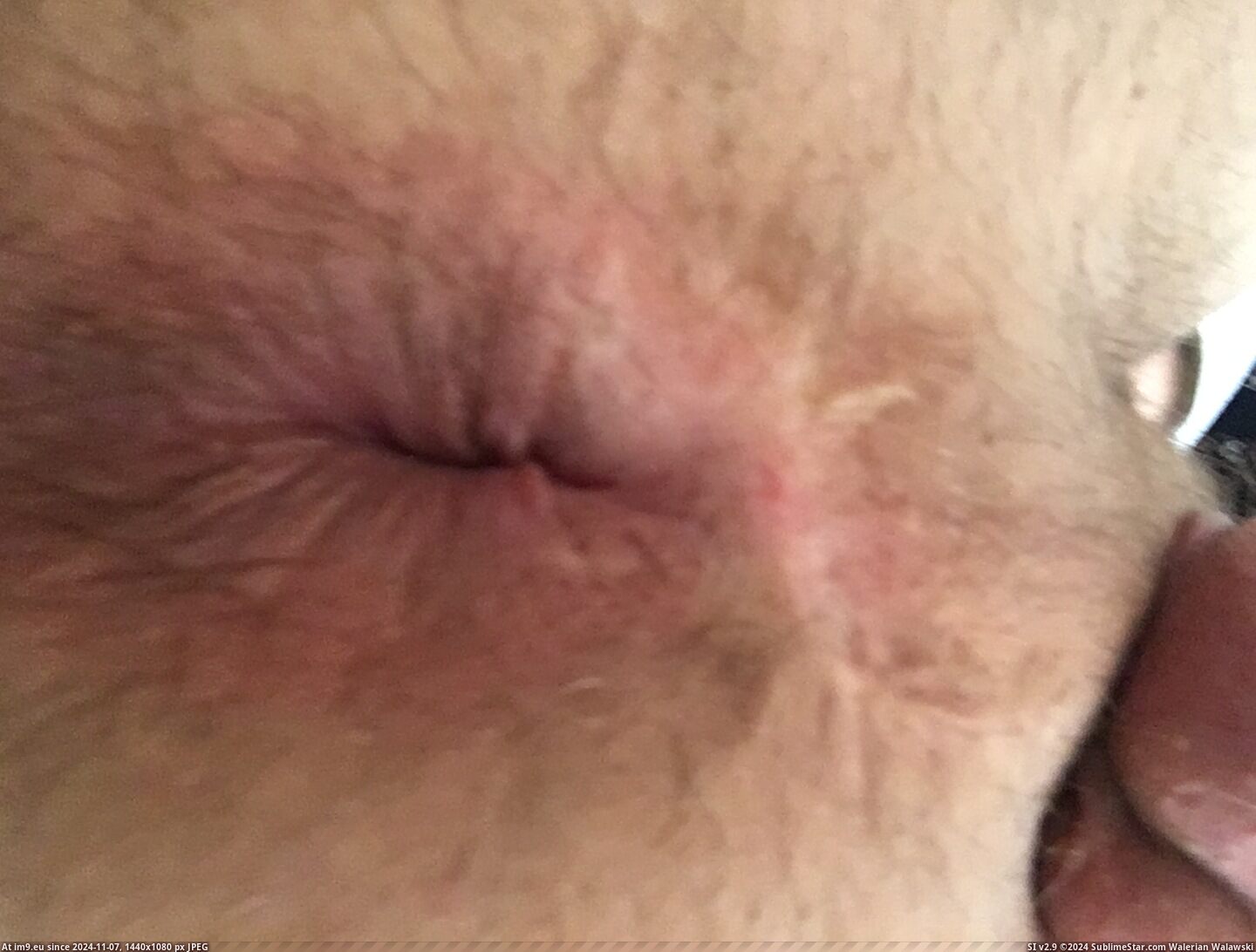 #Upload  #Butthole IMG_5784 Pic. (Obraz z album Instant Upload))