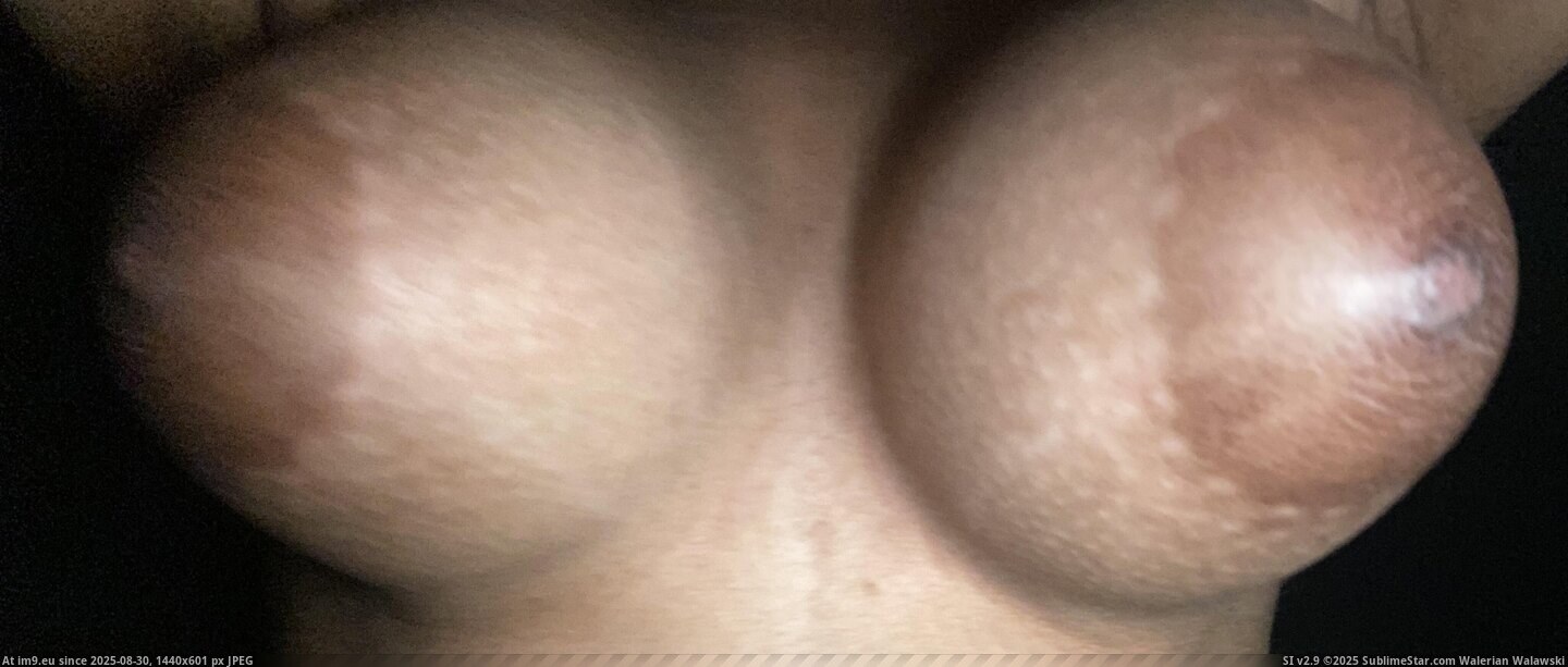 #Tits #Big #Milkers #Boobs IMG_7382 Pic. (Obraz z album meee))