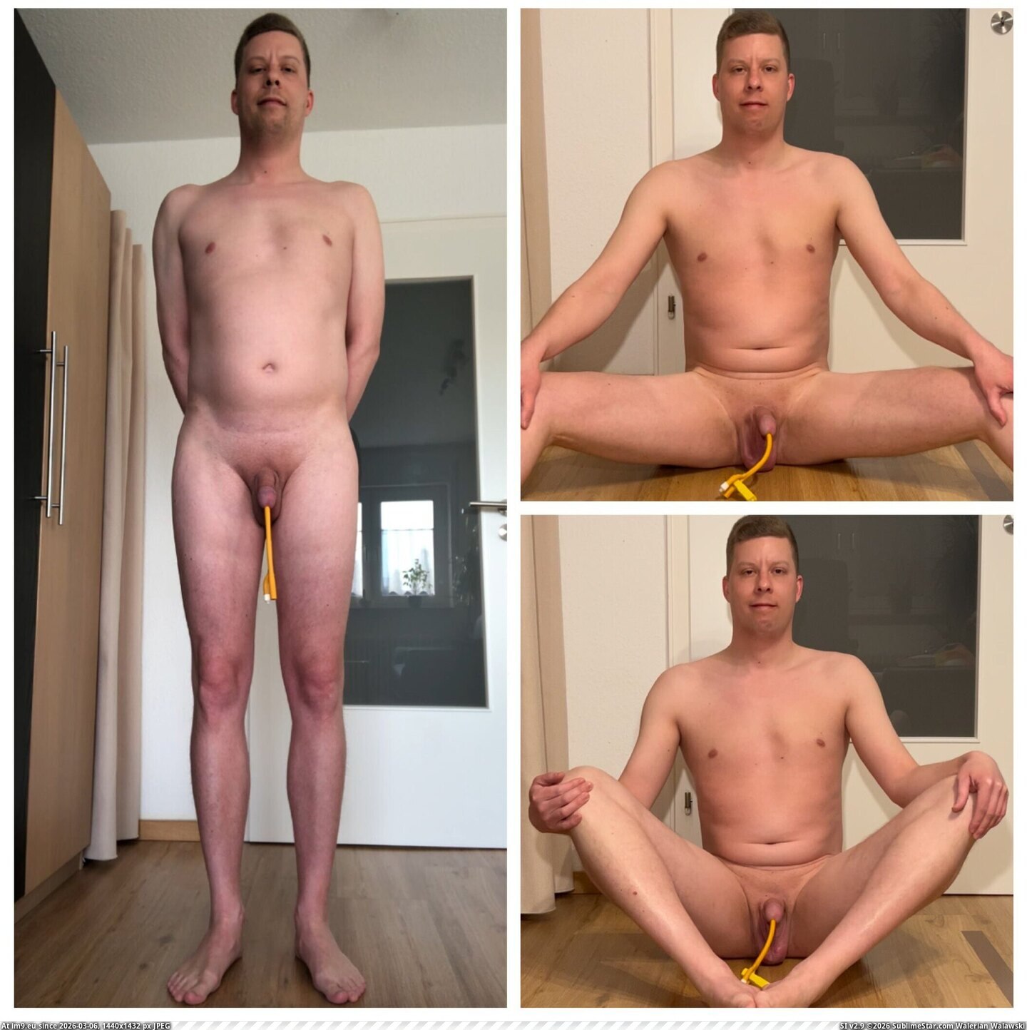 in Jan Klein, Zähringer Straße 12, 79108 Freiburg, Germany - Medartis GmbH incollage_save Pic. (Изображение из альбом Jan Klein, Zähringer Straße 12, 79108 Freiburg, Germany - Medartis GmbH))