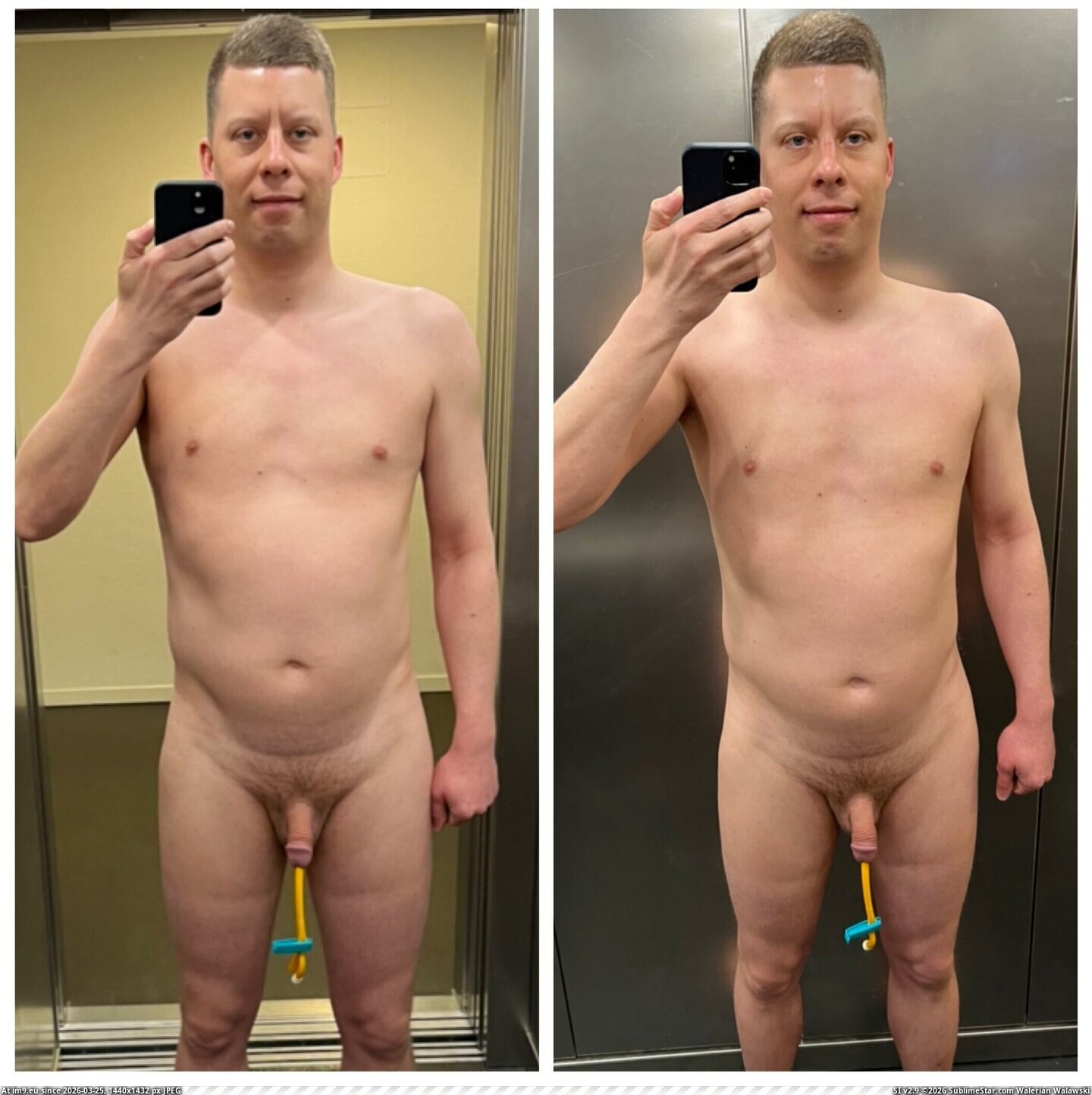 in Jan Klein, Zähringer Straße 12, 79108 Freiburg, Germany - Medartis GmbH incollage_save Pic. (Изображение из альбом Jan Klein, Zähringer Straße 12, 79108 Freiburg, Germany - Medartis GmbH))