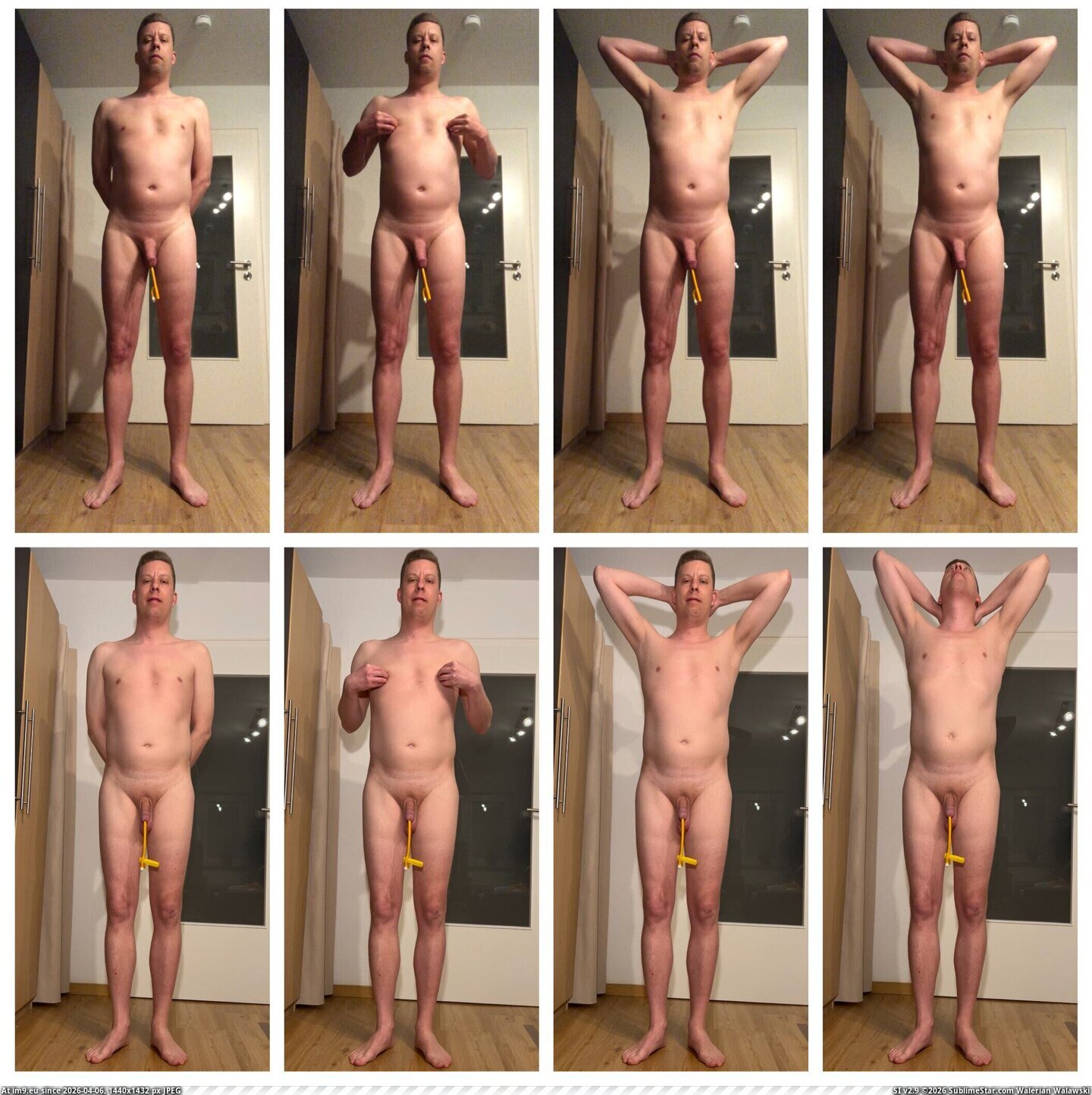 in Jan Klein, Zähringer Straße 12, 79108 Freiburg, Germany - Medartis GmbH incollage_save Pic. (Obraz z album Jan Klein, Zähringer Straße 12, 79108 Freiburg, Germany - Medartis GmbH))