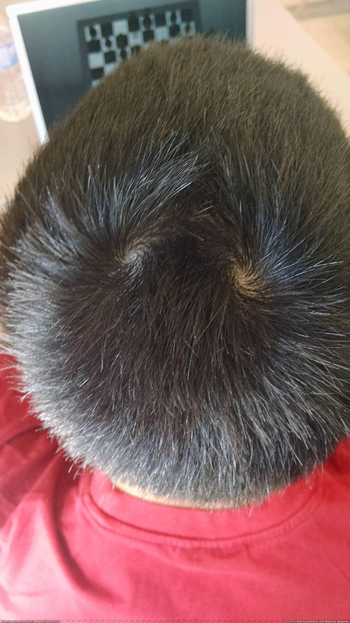 #Friend #Swirls #Head [Mildlyinteresting] My friend has 2 swirls on his head Pic. (Image of album My r/MILDLYINTERESTING favs))