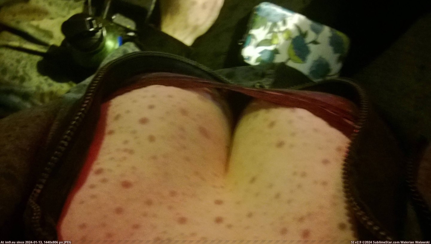 #Boobs #Covered #Rain #Diseased #Pimples #Sickly #Windshield #Droplets #Sorta [Mildlyinteresting] Rain droplets on the windshield made it look like my boobs were covered in sickly diseased pimples [sorta NS Pic. (Image of album My r/MILDLYINTERESTING favs))