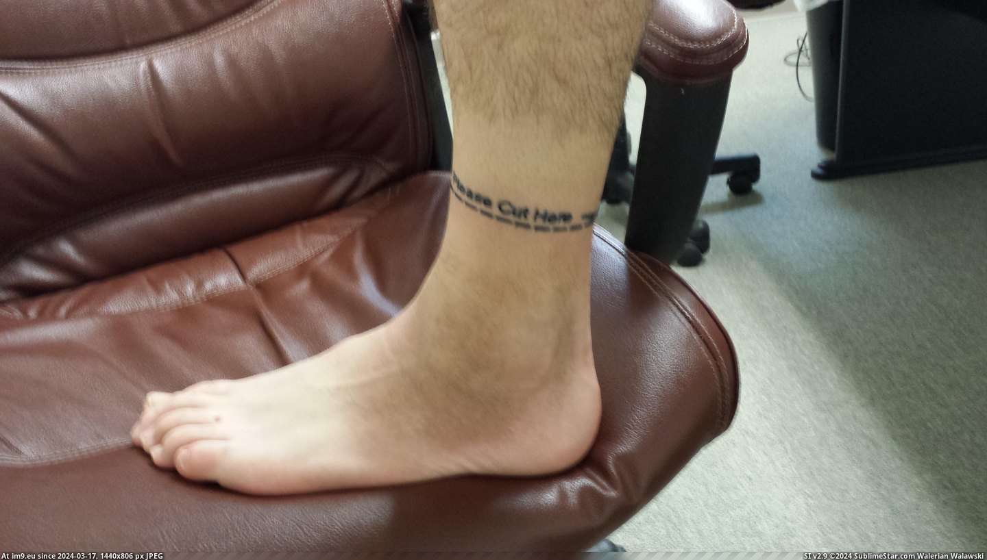 #Two #Ago #Brother #Opted #Amputation #Weeks #Knee #Redditor [Pics] My brother and redditor opted to get a below-the-knee amputation two weeks ago. So he started taking pictures of how we c Pic. (Image of album My r/PICS favs))
