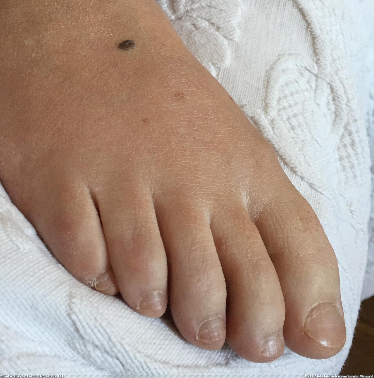 #Wife  #Italian serefeet0114 Pic. (Image of album Italian wife feet))