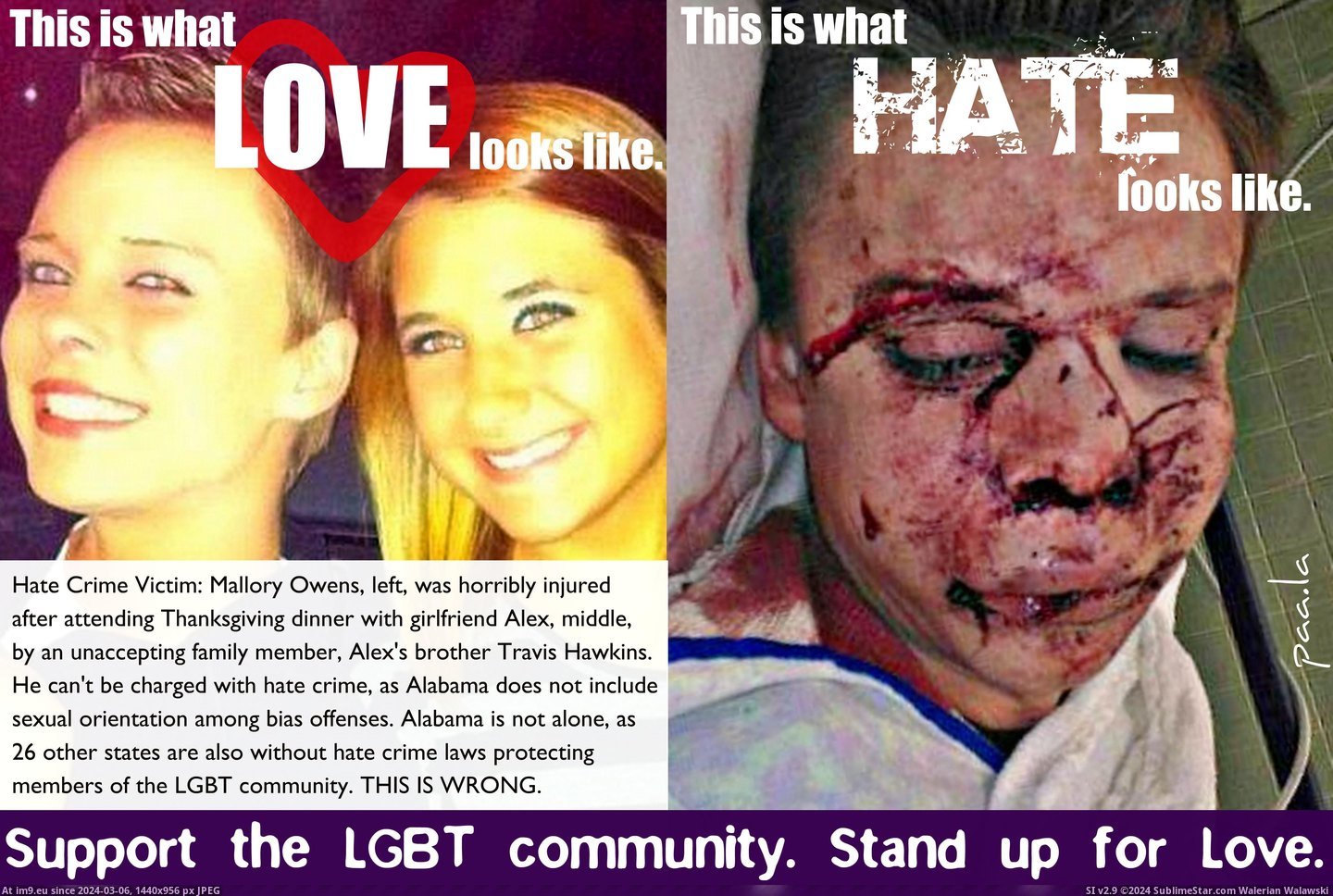 #Love #Hate #Owens #Lgbt #Victim #Stand #Crime Stand up for love! LGBT Hate Crime Victim Mallory Owens Pic. (Image of album Rehost))