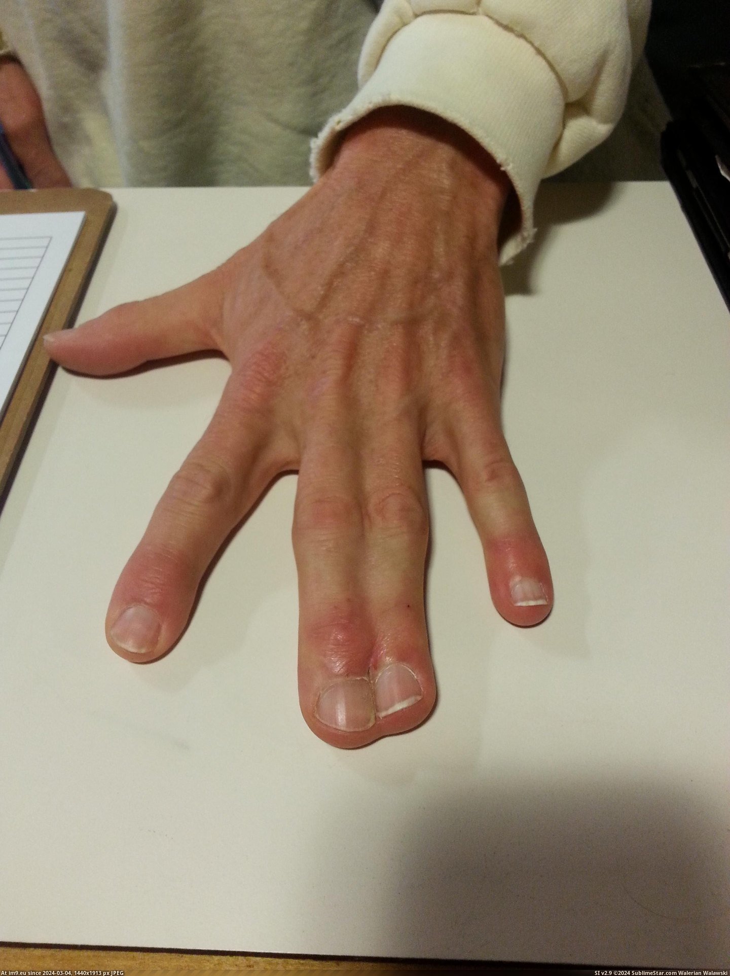 #Wtf  #Fingers [Wtf] Four Fingers 2 Pic. (Obraz z album My r/WTF favs))