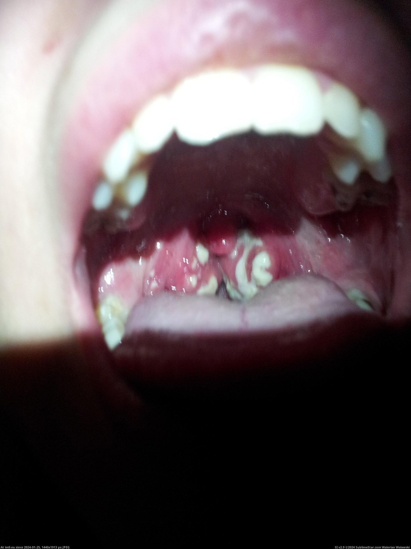 #Wtf #Throat #Hurt #She [Wtf] She said her throat hurt Pic. (Image of album My r/WTF favs))