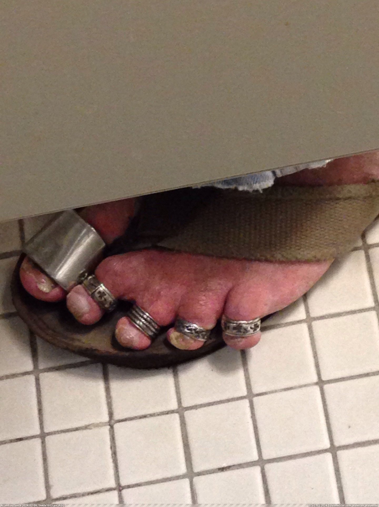 #Wtf #Why #Hate #Feet [Wtf] This is why I hate feet. Pic. (Obraz z album My r/WTF favs))